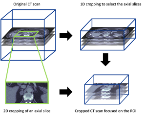 Adrenal cropping